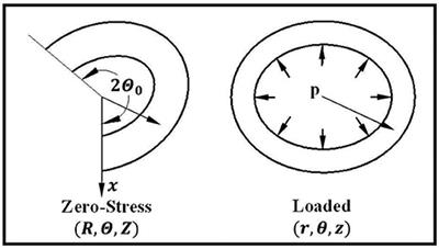 Buckling of Arteries With Noncircular Cross Sections: Theory and Finite Element Simulations